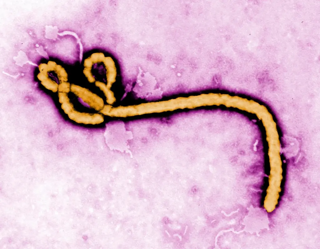 An image by the Centers for Disease Control and Prevention (CDC) shows an Ebola virus virion.
